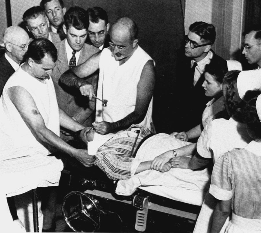 PSYCHOSURGERY BRUTALITY: American psychiatrist Walter Freeman (above, center) developed the frontal lobotomy, a barbarous act which plunged an icepick-like instrument beneath the eyelid and, using a surgical mallet, drove it through the eye socket bone and into the brain. Movement of the instrument severed the fibers of the frontal brain lobes, causing irreversible brain damage.